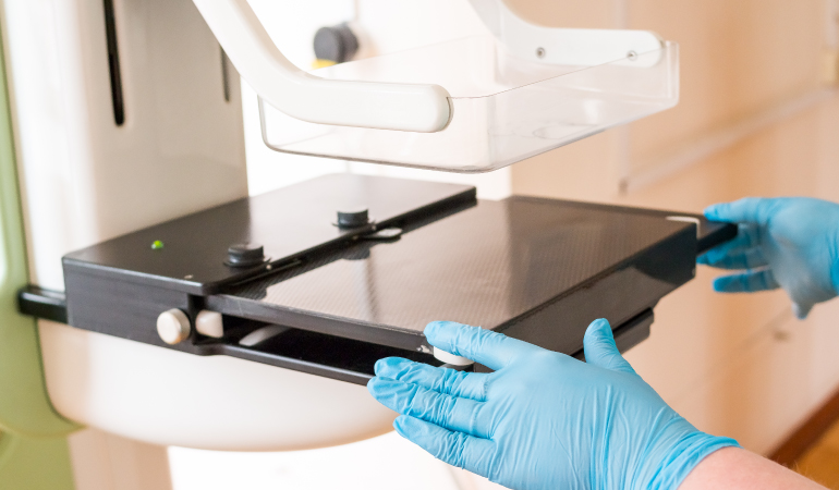 Mammography Solution for PACS Workstations